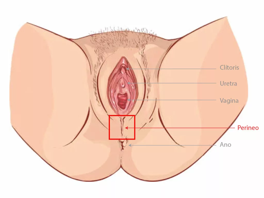 Perineoplastia